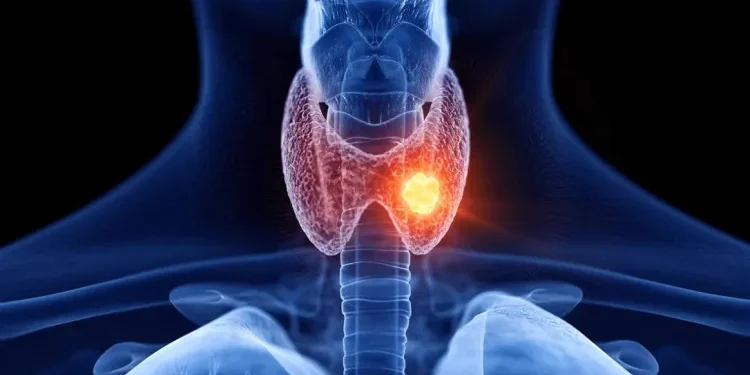 Estudo aponta que bloquear receptor da tireoide TRβ impede avanço do câncer de próstata.