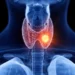 Estudo aponta que bloquear receptor da tireoide TRβ impede avanço do câncer de próstata.