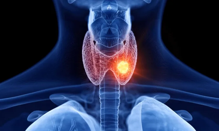 Estudo aponta que bloquear receptor da tireoide TRβ impede avanço do câncer de próstata.