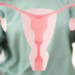 Projeto que cria licença menstrual é aprovado na Câmara e segue para o Senado