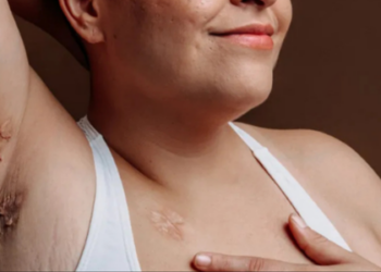 Doenças dermatológicas afetam rotina e saúde emocional de milhares de pacientes