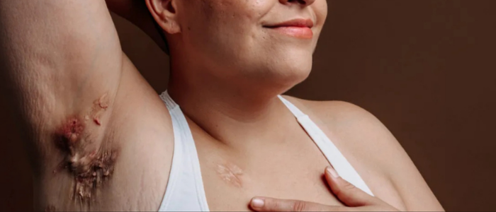 Doenças dermatológicas afetam rotina e saúde emocional de milhares de pacientes