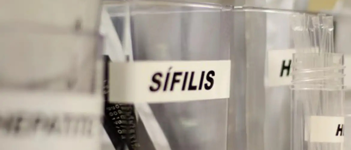 Sífilis em gestantes preocupa o Brasil. Entre 2005 e 2025, foram registrados 810 mil casos, principalmente no Sudeste. Especialistas alertam para prevenção, diagnóstico precoce e tratamento do parceiro.