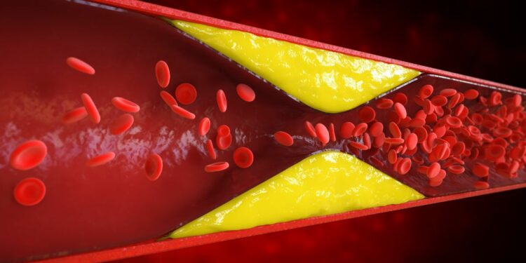 Prevenção cardiovascular com mudanças simples no dia a dia.