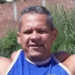 A morte de Arlindo de Souza, o Popeye Brasileiro, reacende debate sobre os riscos do uso de anabolizantes e óleo mineral para fins estéticos.