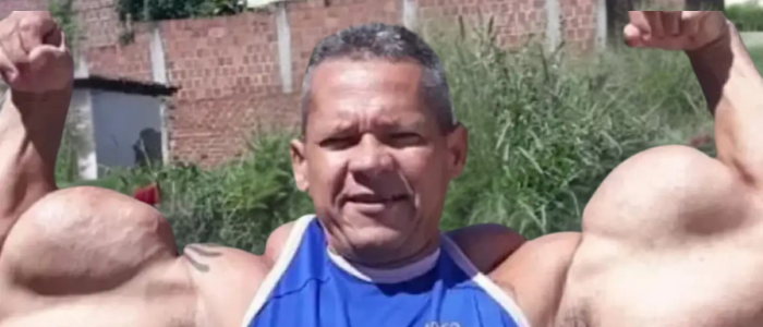 A morte de Arlindo de Souza, o Popeye Brasileiro, reacende debate sobre os riscos do uso de anabolizantes e óleo mineral para fins estéticos.