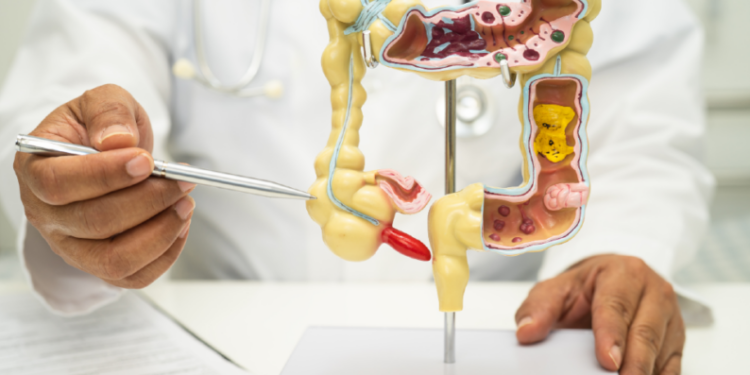 Modulação da microbiota intestinal por transplante fecal melhora eficácia da imunoterapia, indicam estudos.