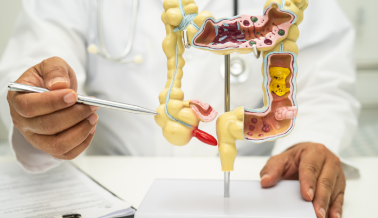 Modulação da microbiota intestinal por transplante fecal melhora eficácia da imunoterapia, indicam estudos.