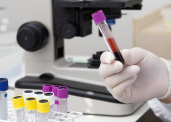 LATE é uma condição neurológica ligada à proteína TDP-43 que pode ser confundida com Alzheimer em idosos. Entenda sintomas, desafios do diagnóstico e pesquisas sobre tratamentos.