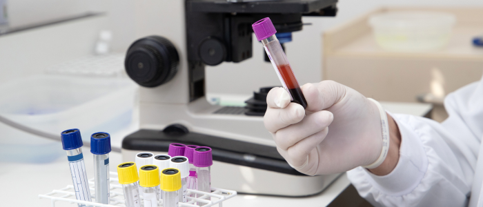 LATE é uma condição neurológica ligada à proteína TDP-43 que pode ser confundida com Alzheimer em idosos. Entenda sintomas, desafios do diagnóstico e pesquisas sobre tratamentos.