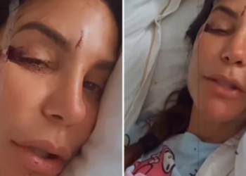 Ivete Sangalo, de 53 anos, foi internada no Hospital Aliança em Salvador após desmaio causado por virose e desidratação. Artista passa bem e recebe acompanhamento médico.