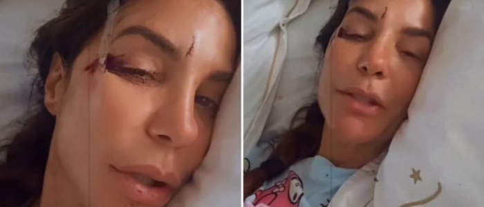 Ivete Sangalo, de 53 anos, foi internada no Hospital Aliança em Salvador após desmaio causado por virose e desidratação. Artista passa bem e recebe acompanhamento médico.