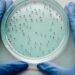 Pesquisa publicada na Nature Microbiology aponta relação direta entre microbioma e imunidade em pacientes com HIV.