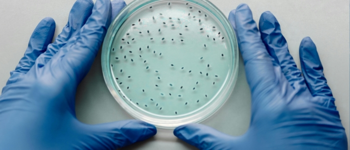 Pesquisa publicada na Nature Microbiology aponta relação direta entre microbioma e imunidade em pacientes com HIV.
