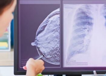 Estudo indica imunoterapia capaz de prevenir retorno do tumor agressivo.