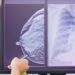 Estudo indica imunoterapia capaz de prevenir retorno do tumor agressivo.