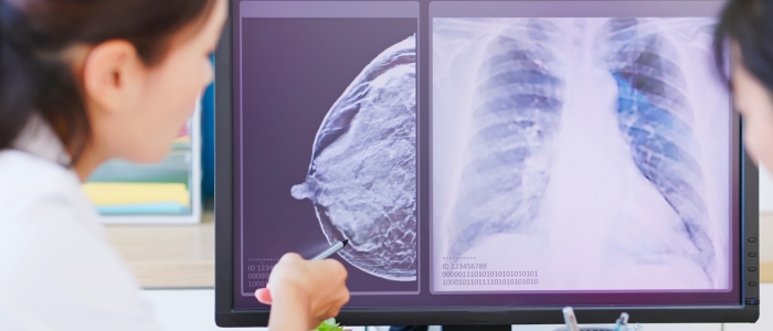 Estudo indica imunoterapia capaz de prevenir retorno do tumor agressivo.