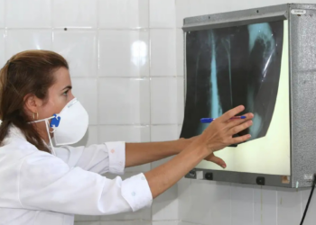 OMS destaca importância de testes rápidos para tuberculose e alerta para alta mortalidade global. Brasil registrou mais de 84 mil casos em 2024.