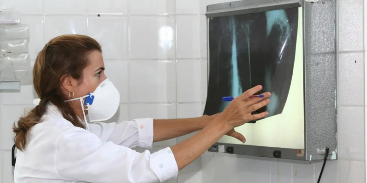 OMS destaca importância de testes rápidos para tuberculose e alerta para alta mortalidade global. Brasil registrou mais de 84 mil casos em 2024.