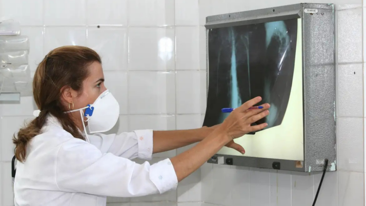 OMS destaca importância de testes rápidos para tuberculose e alerta para alta mortalidade global. Brasil registrou mais de 84 mil casos em 2024.