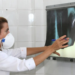 OMS destaca importância de testes rápidos para tuberculose e alerta para alta mortalidade global. Brasil registrou mais de 84 mil casos em 2024.
