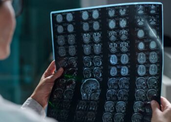 Estudo da Nature aponta influência hormonal em tumor cerebral infantil raro.