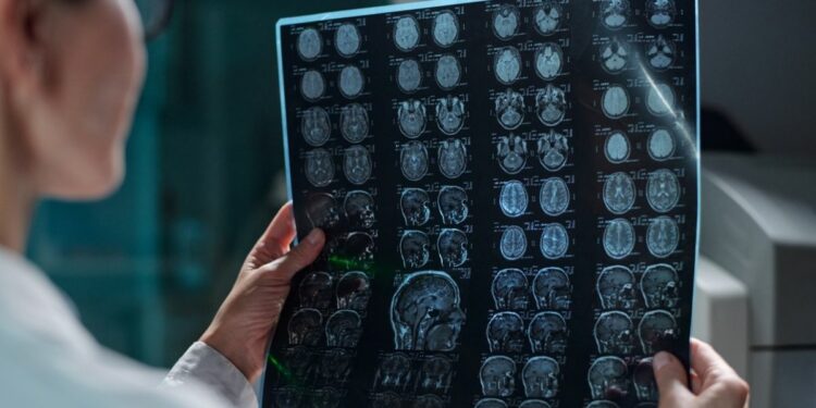 Estudo da Nature aponta influência hormonal em tumor cerebral infantil raro.