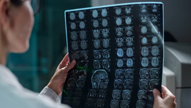 Estudo da Nature aponta influência hormonal em tumor cerebral infantil raro.