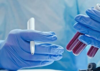 Estudo mostra que exame de sangue pode prever risco de demência décadas antes.