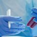 Estudo mostra que exame de sangue pode prever risco de demência décadas antes.