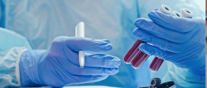 Estudo mostra que exame de sangue pode prever risco de demência décadas antes.