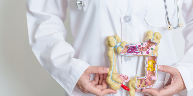 SUS adotará novo exame para rastrear câncer de intestino em pessoas sem sintomas