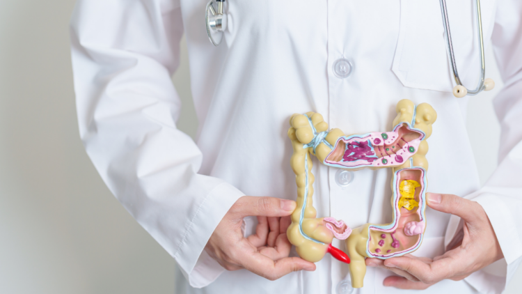 SUS adotará novo exame para rastrear câncer de intestino em pessoas sem sintomas