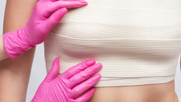 Mulheres mastectomizadas terão direito ao fornecimento gratuito.
