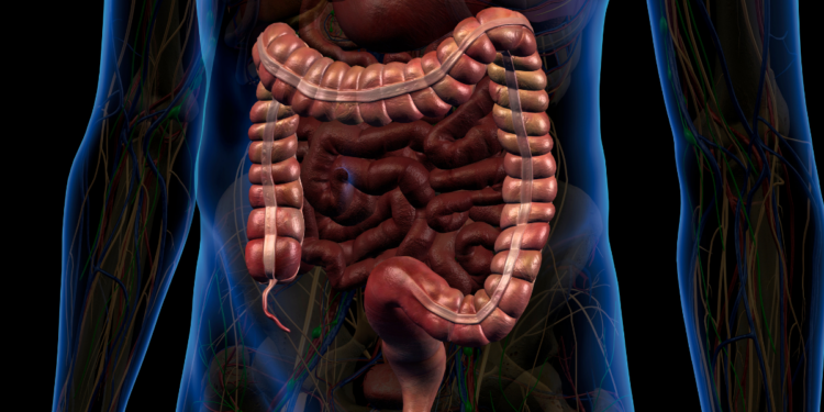 Campanha Maio Roxo destaca a importância do diagnóstico precoce das doenças inflamatórias intestinais, como Crohn e retocolite ulcerativa.
