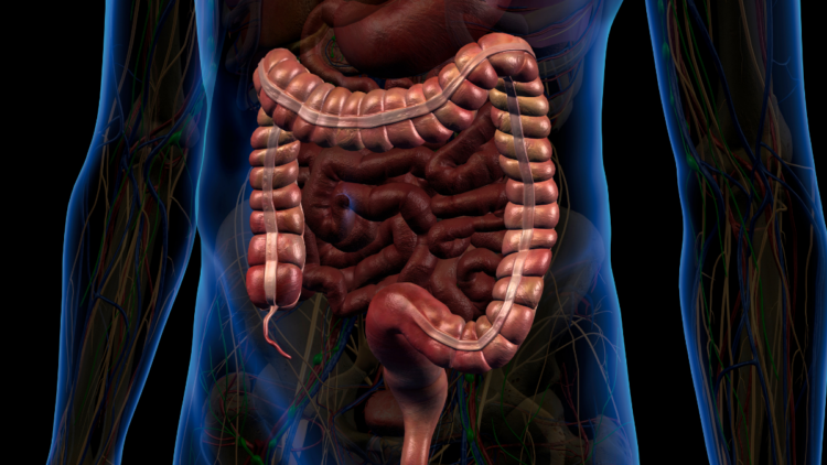 Campanha Maio Roxo destaca a importância do diagnóstico precoce das doenças inflamatórias intestinais, como Crohn e retocolite ulcerativa.