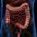 Campanha Maio Roxo destaca a importância do diagnóstico precoce das doenças inflamatórias intestinais, como Crohn e retocolite ulcerativa.