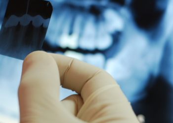 Pesquisadores da USP desenvolveram IA capaz de identificar dentes e detectar cáries em radiografias panorâmicas.
