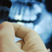 Pesquisadores da USP desenvolveram IA capaz de identificar dentes e detectar cáries em radiografias panorâmicas.