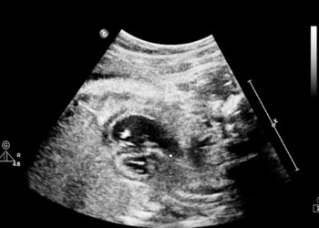 Quissamã passa a oferecer ecocardiograma fetal e infantil pelo SUS municipal. Exames serão realizados no Centro de Especialidades.