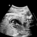 Quissamã passa a oferecer ecocardiograma fetal e infantil pelo SUS municipal. Exames serão realizados no Centro de Especialidades.