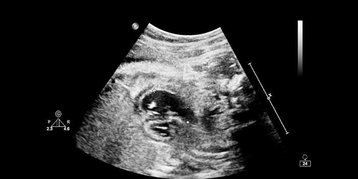 Quissamã passa a oferecer ecocardiograma fetal e infantil pelo SUS municipal. Exames serão realizados no Centro de Especialidades.