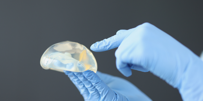 Entenda quanto tempo dura um implante de silicone, os sinais de ruptura e quando médicos podem recomendar a troca da prótese.
