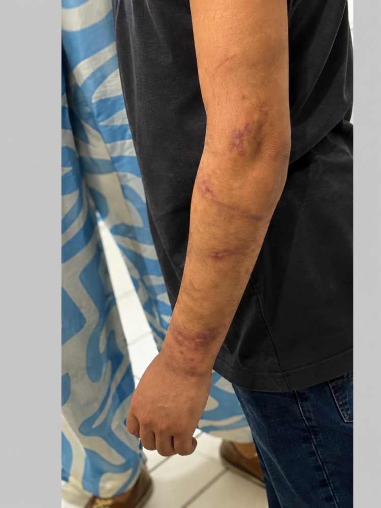 Criança chegou à escola, em Araruama, com dores e marcas de agressão — Foto: Polícia Civil