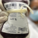 Ministério da Saúde aprova protocolo para oferecer emicizumabe pelo SUS a crianças de até 6 anos com hemofilia A sem inibidores do fator VIII.